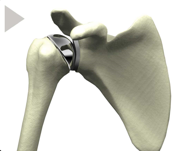 Medical Device Research